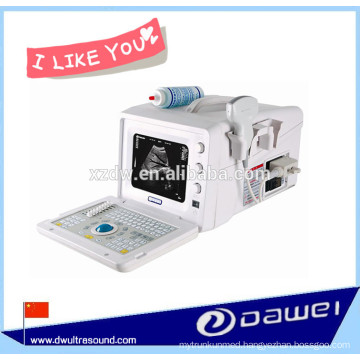 cheapest portable ultrasound machine & b w ultrasound scanner for obstetrics,gynecology